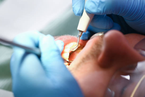 Best Emergency Broken Tooth Repair in Wathena, KS