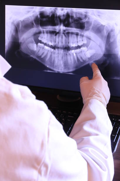 Best Emergency Wisdom Teeth Removal in Wathena, KS