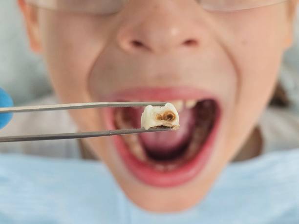 Best Emergency Treatment for Toothache in Wathena, KS
